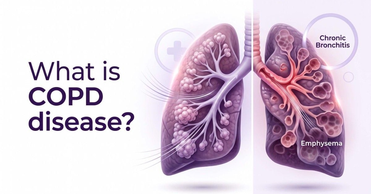 What is COPD disease