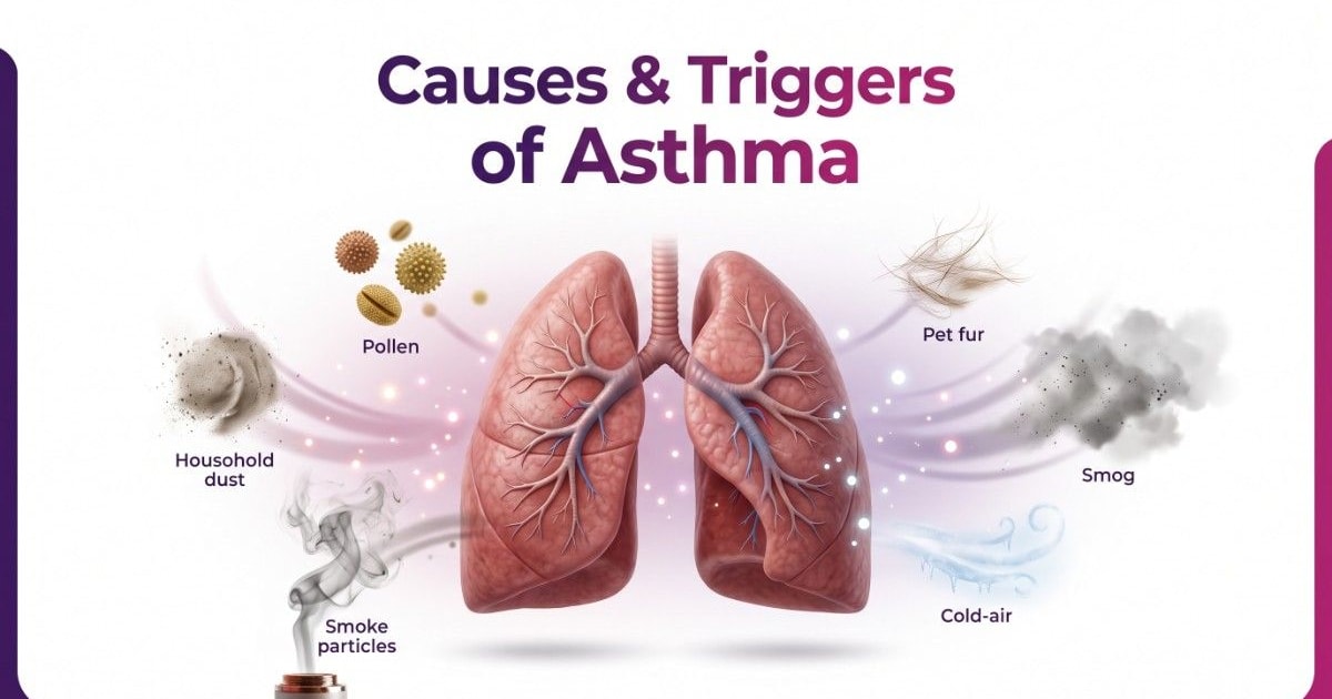 Causes & triggers asthma