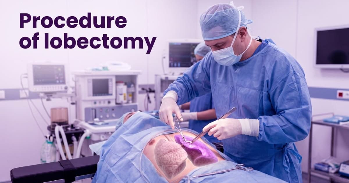 Procedure of lobectomy