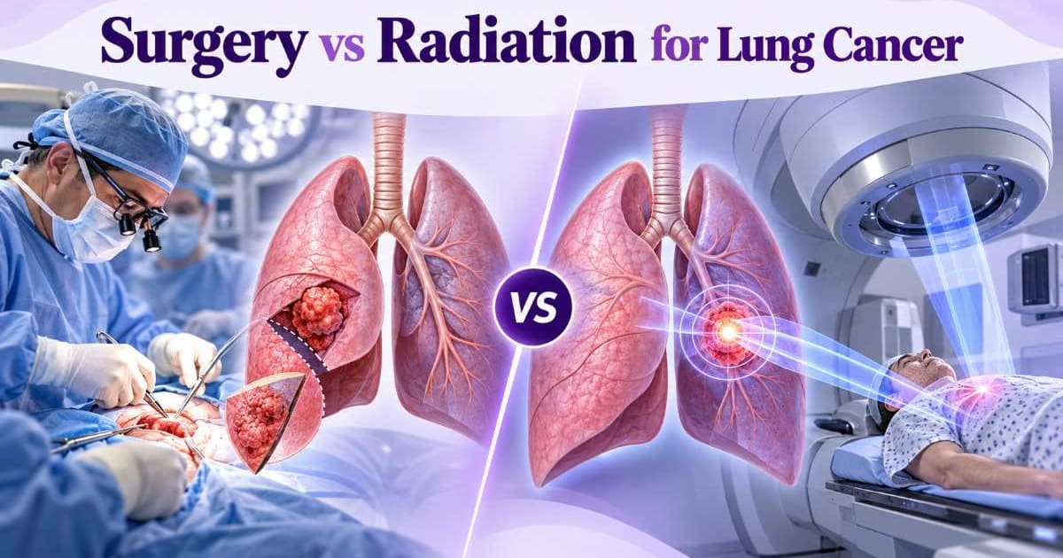 Surgery vs Radiation for Lung Cancer