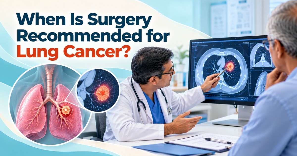 When is surgery recommended for lung cancer?