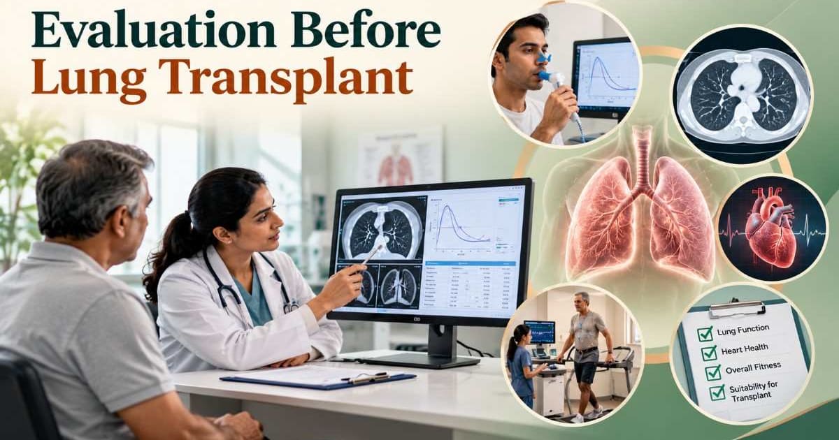 Evaluation Before Lung Transplant