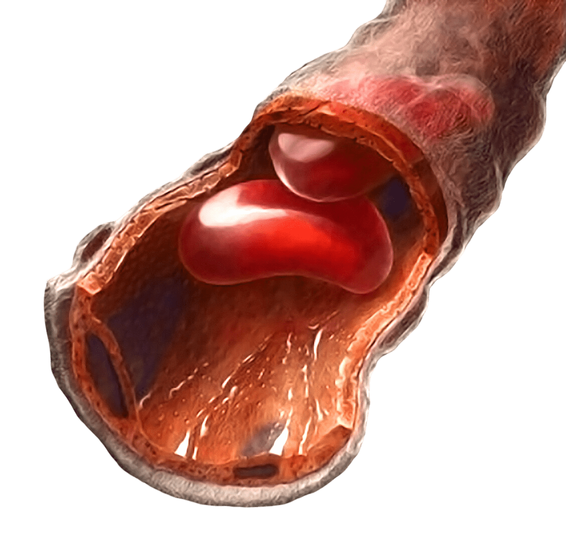 GLP-1 and Blood Sugar Crashes: The Surprising Truth Behind the Fear