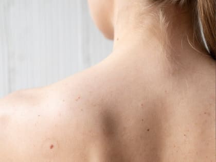 Заболевания кожи: важные аспекты диагностики и лечения в Подмосковье