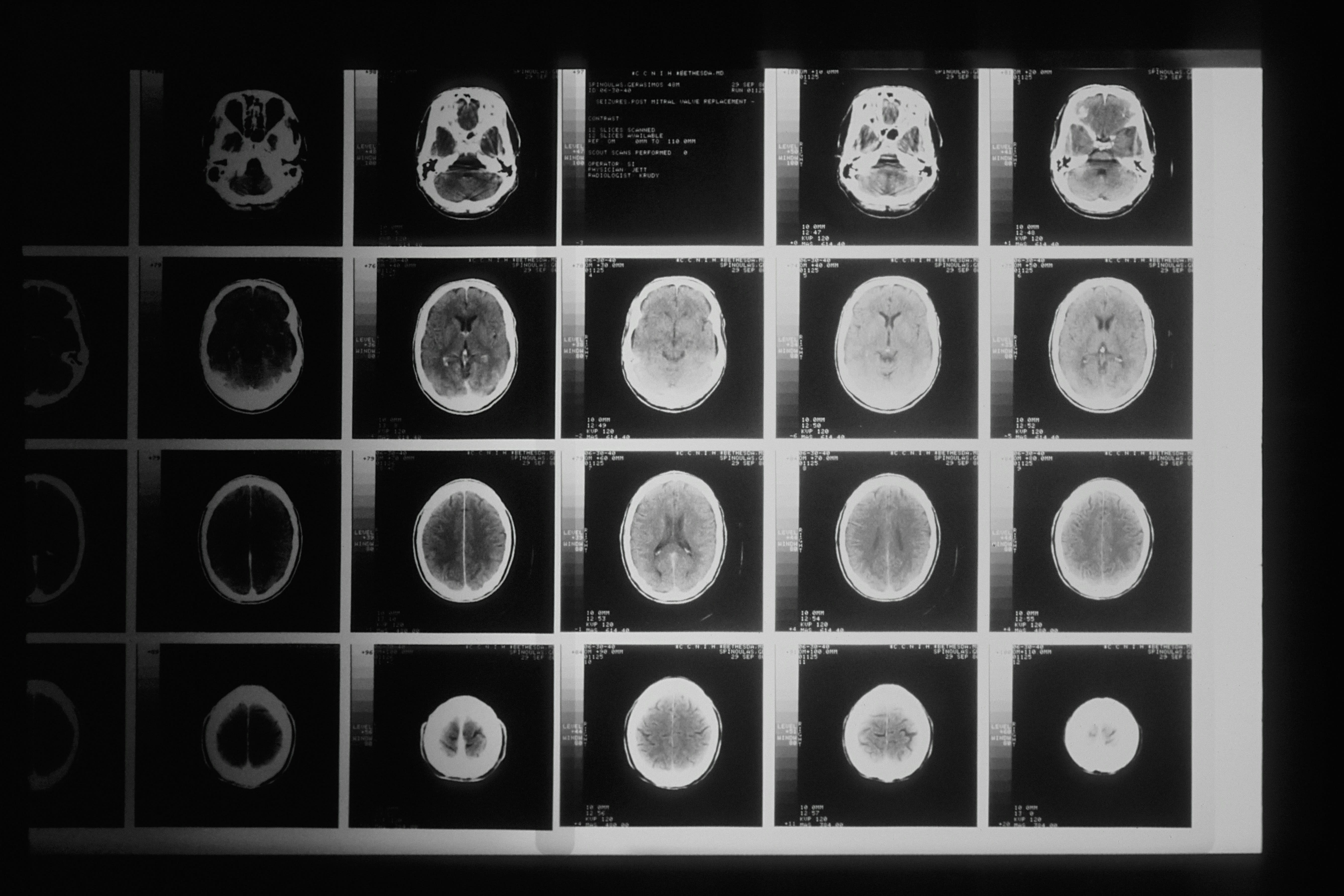 A concept image representing scientific brain research on how different sounds affect focus.