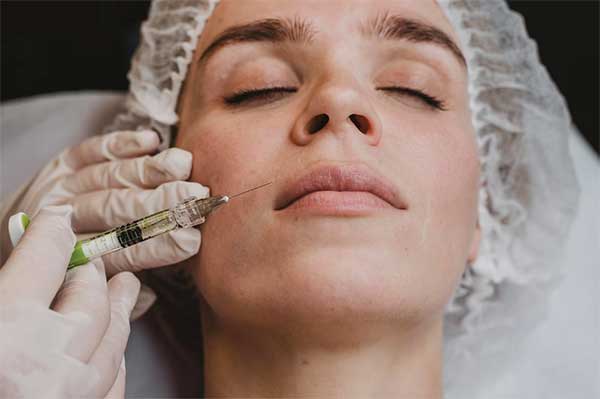 Bótox labios
