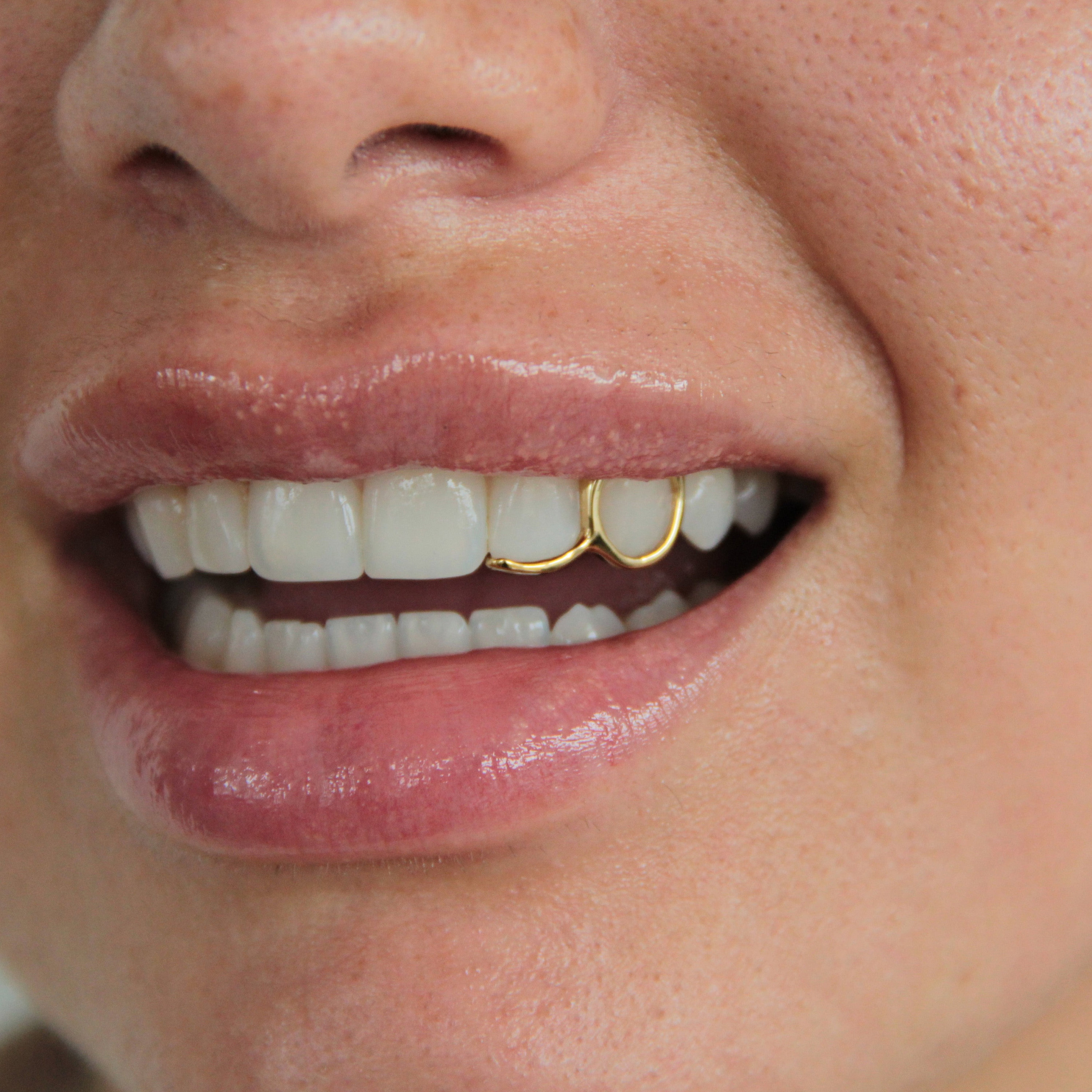 10K Gold Single Tooth Cap