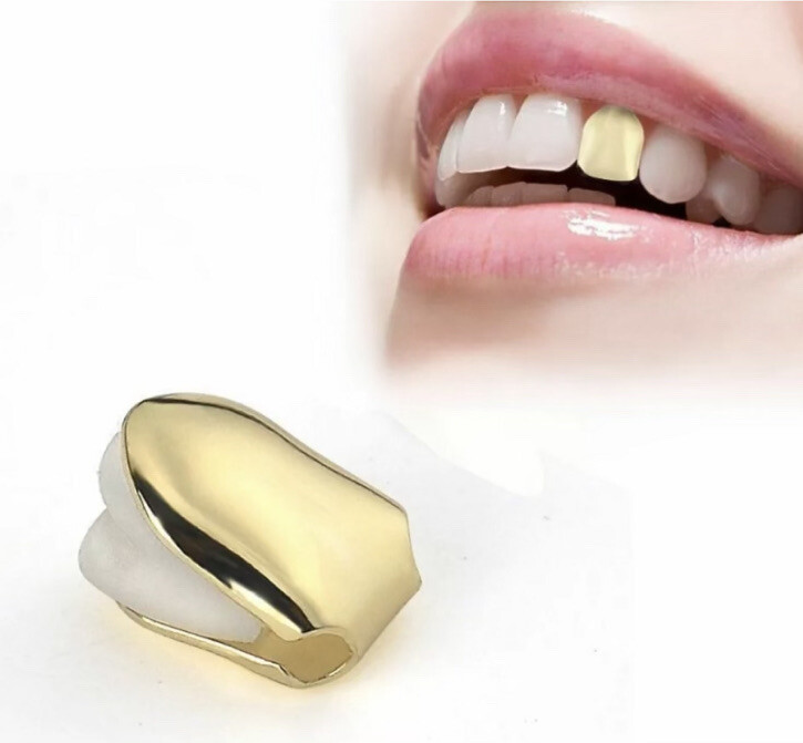 Gold-Plated Single Tooth Cap