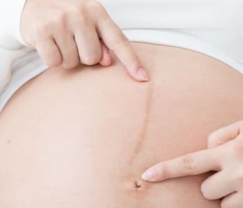 334_ligne-brune-ventre-grossesse