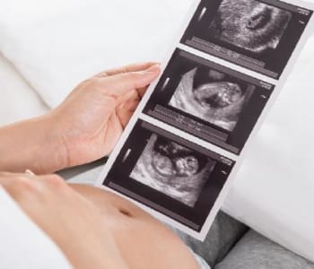 La première échographie