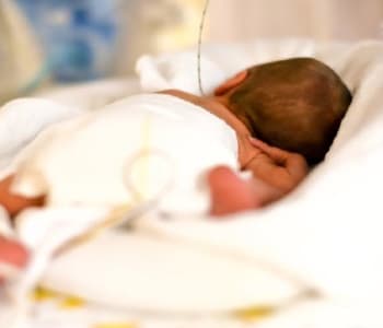 Bébé est né prématurément
