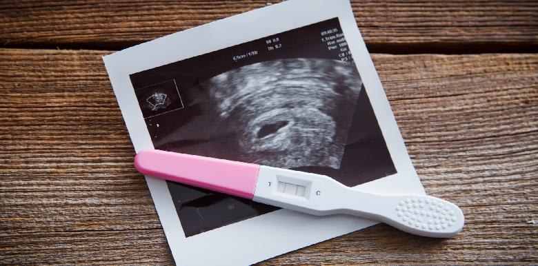 197_Fotolia_78322771_Subscription_Monthly_M