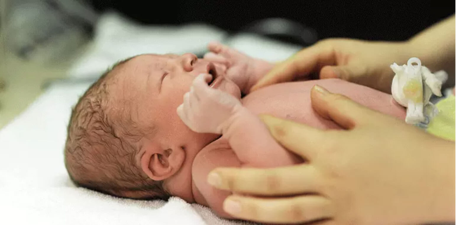 Bébé est en siège : puis-je accoucher par voie basse ?