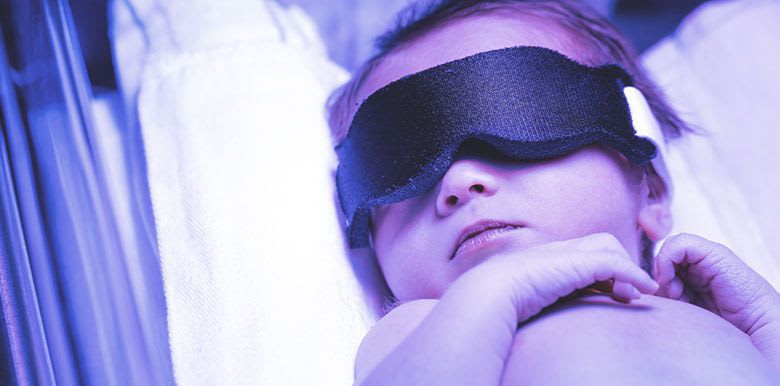 Tout savoir sur la jaunisse du nourrisson ou ictère