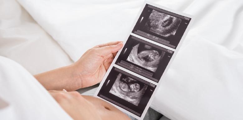 Ma grossesse : semaine 9 (11 SA)