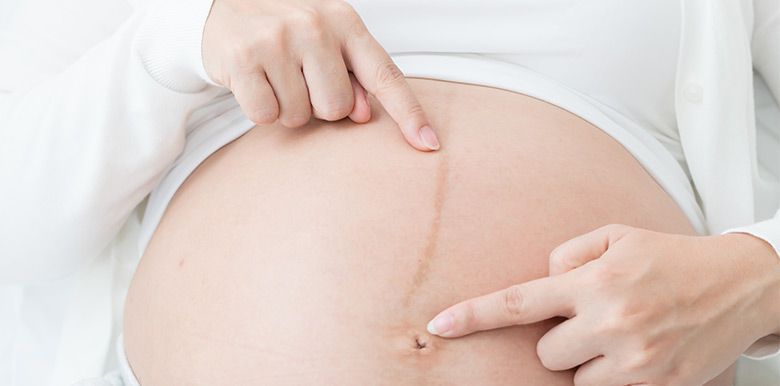 Faux ventre de femme enceinte, Fabriquer pour un cours du C…