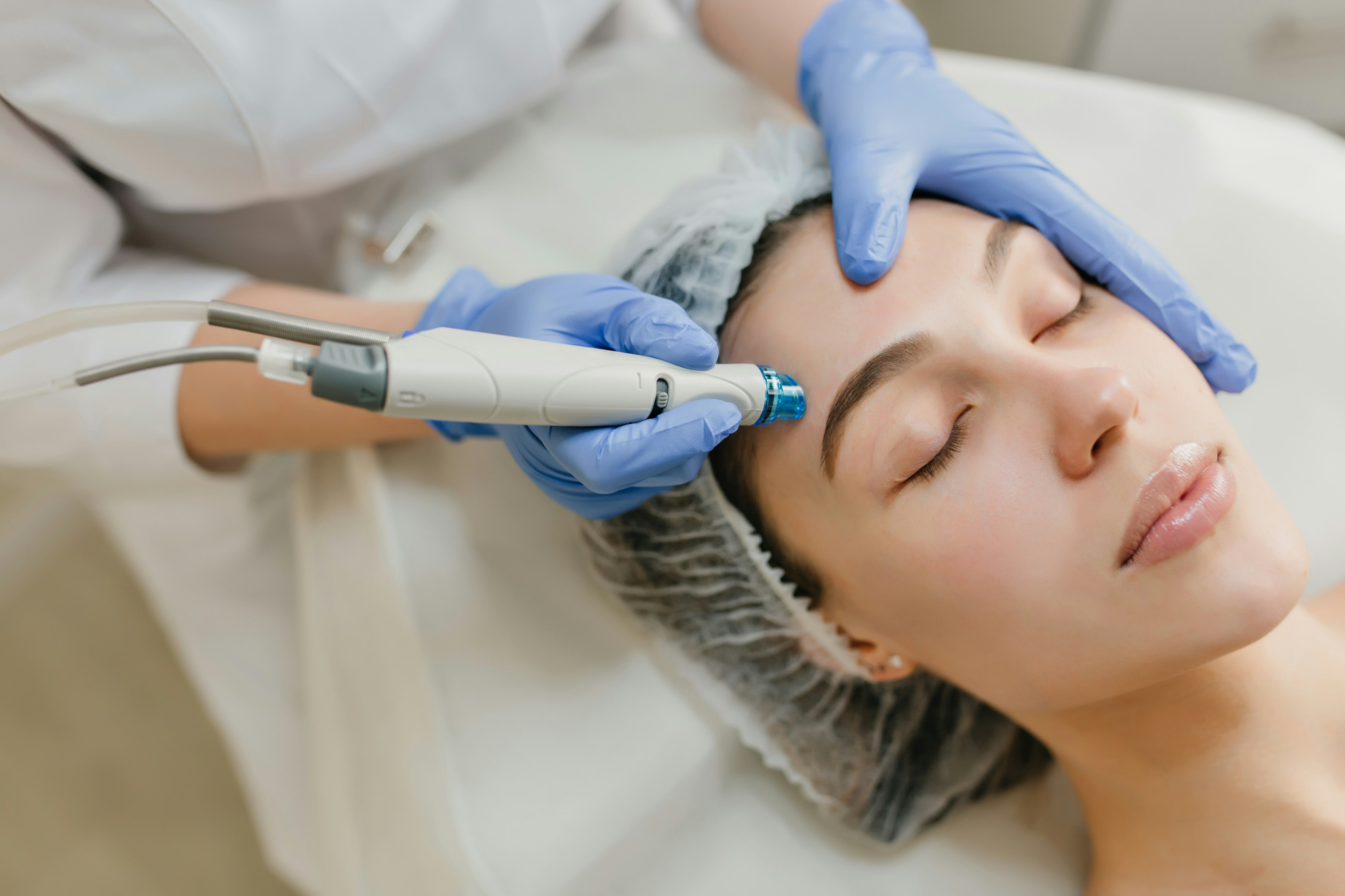 Facial Laser Hair Removal for Women: A Permanent Solution to Unwanted Hair