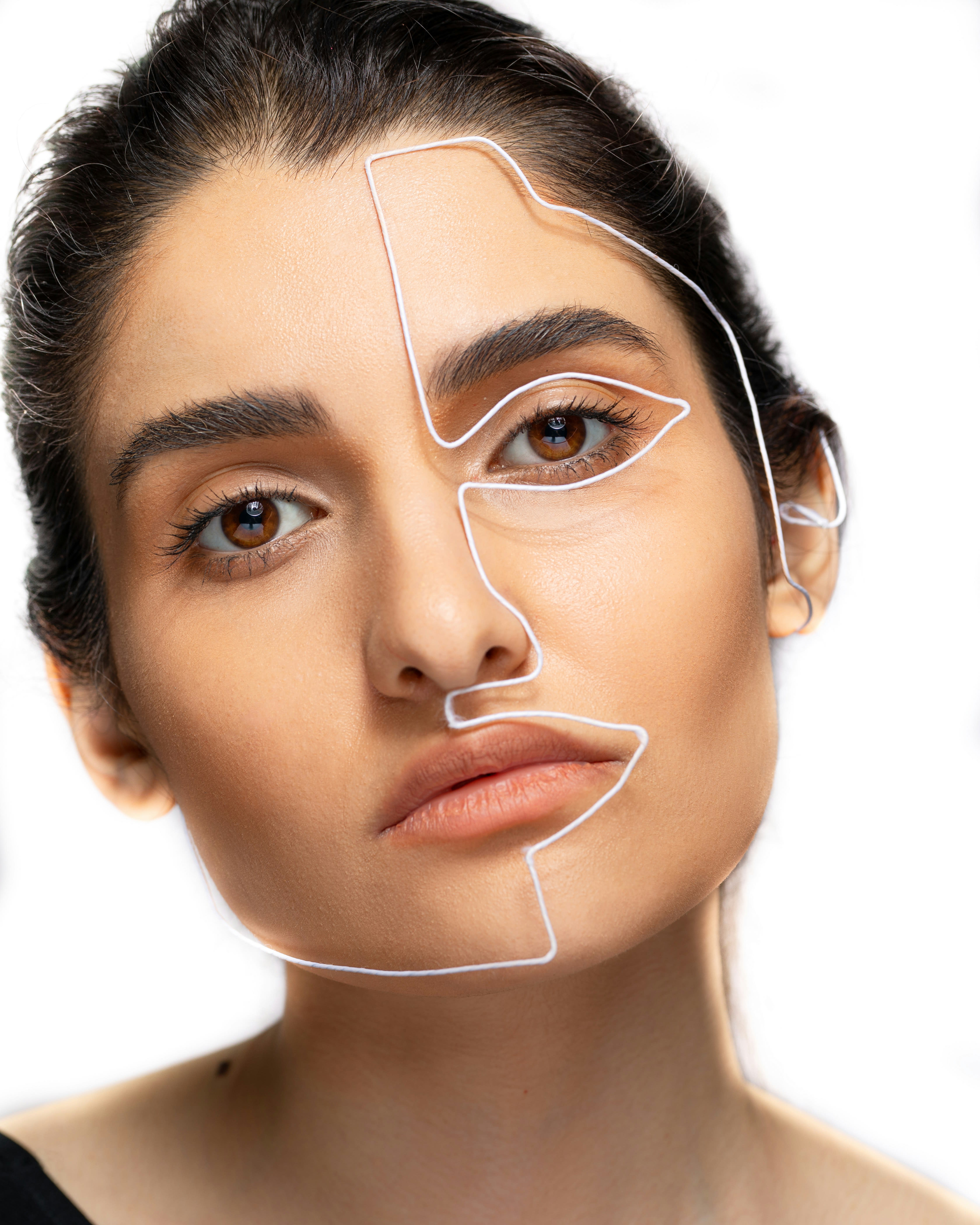 Cheek Filler Before and After: What Realistic Results Look Like