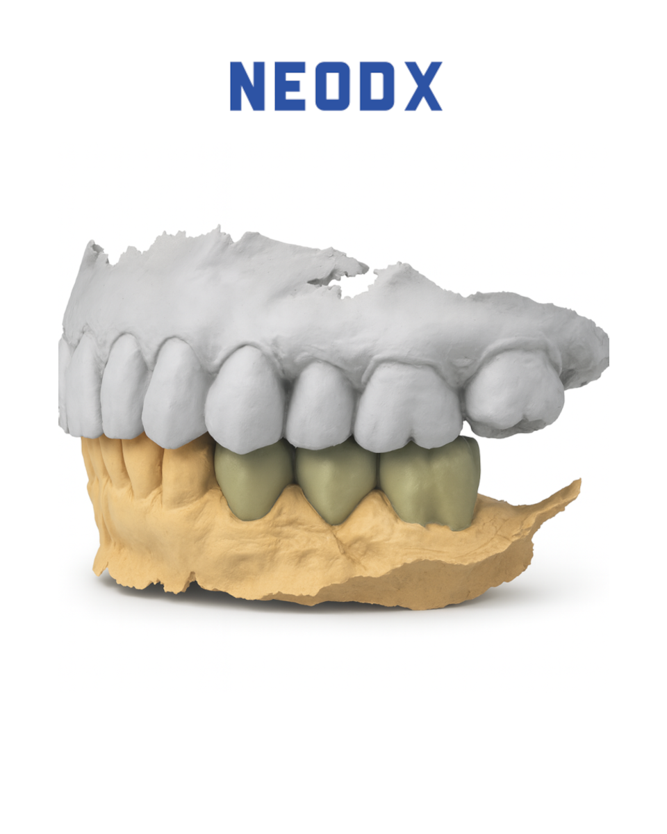 Crown and Bridge Design