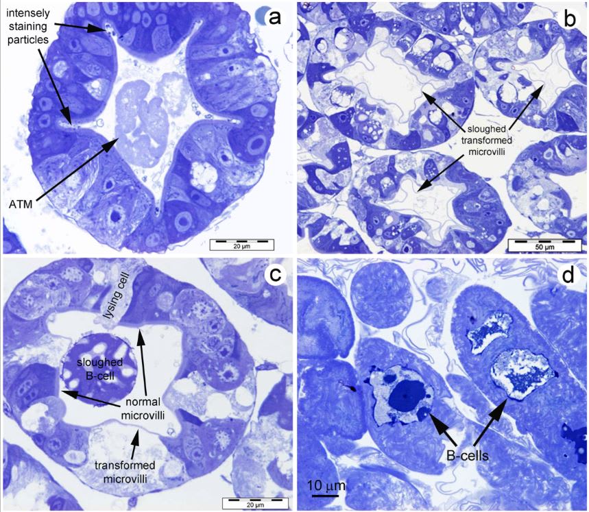 Bệnh Vermiform trên tôm