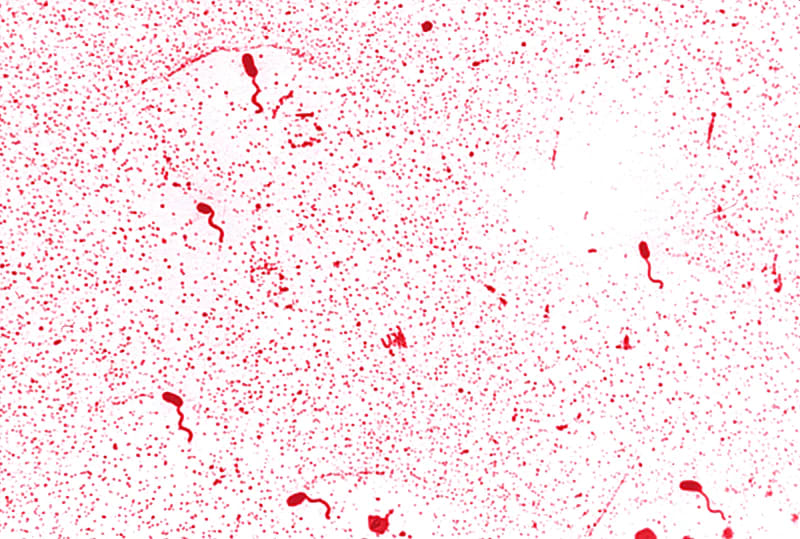 Hình thái vi khuẩn Vibrio harveyi