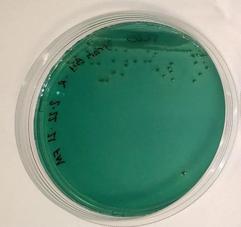 Test Vibrio parahaemolyticus trên đĩa thạch TCBS
