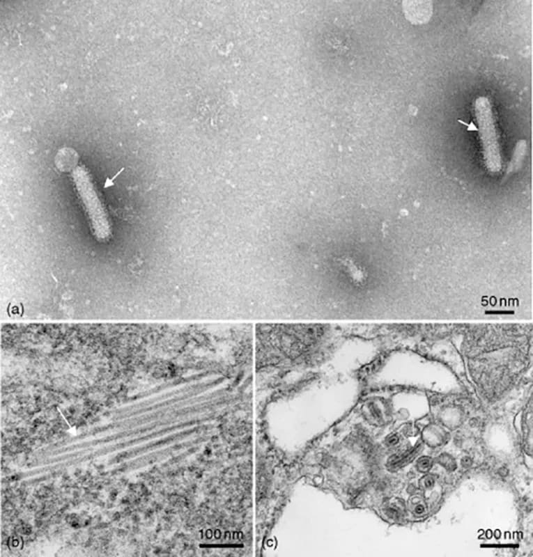Virus YHV