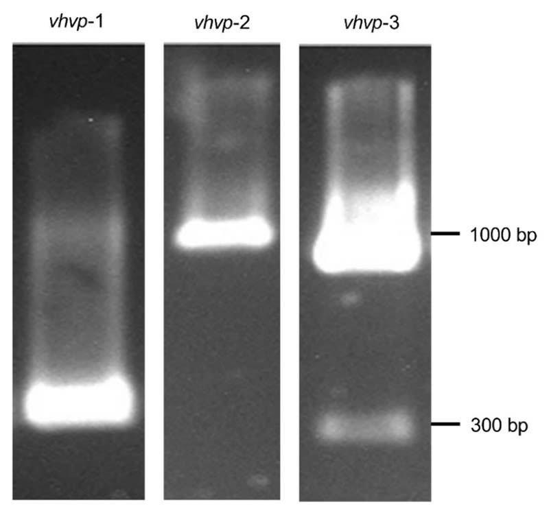 Xét nghiệm PCR của mầm bệnh TPD