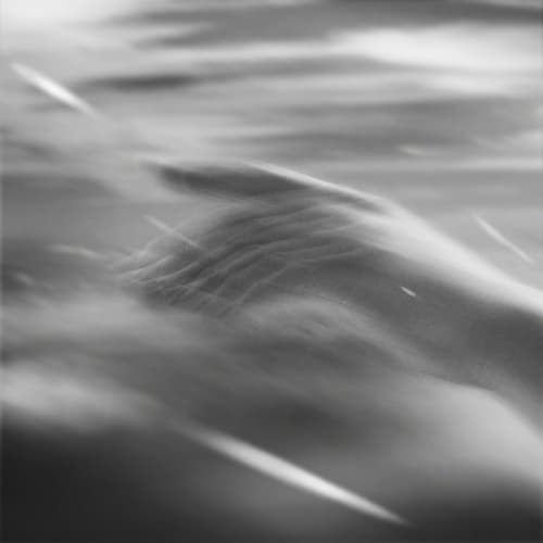 vết thương cover