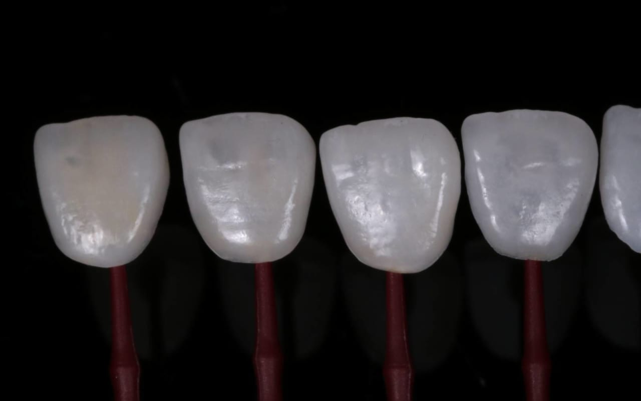 Lab 39 Cosmetic Dental Laboratory London