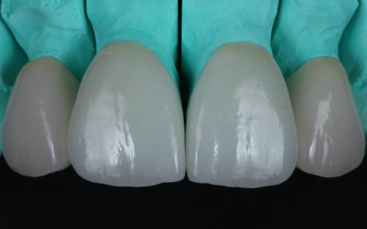 Lab 39 Cosmetic Dental Laboratory London