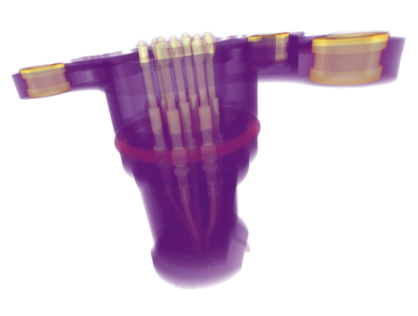 3‑D rendering of CT volume