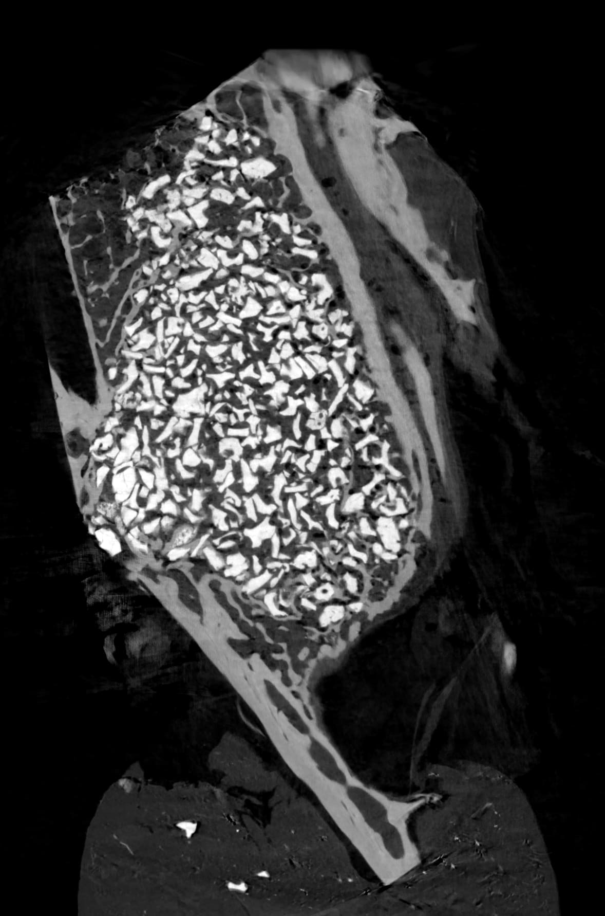 Improved 2D slice of bone sample using Voxray QRT
