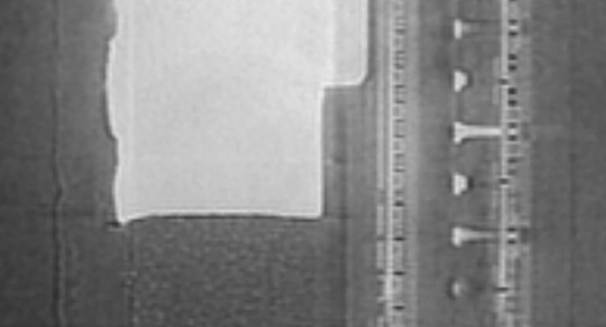 Noisy CT slice reconstructed with QRT without TV denoising