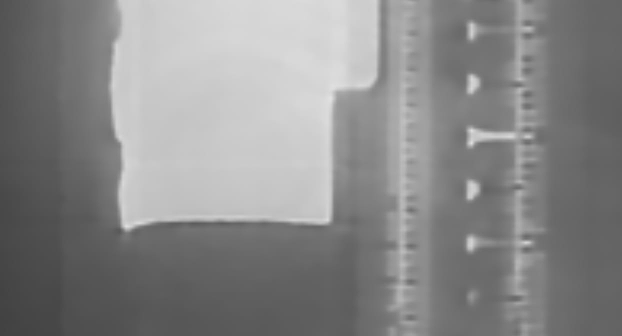 The same CT slice reconstructed with QRT and sub-voxel TV denoising