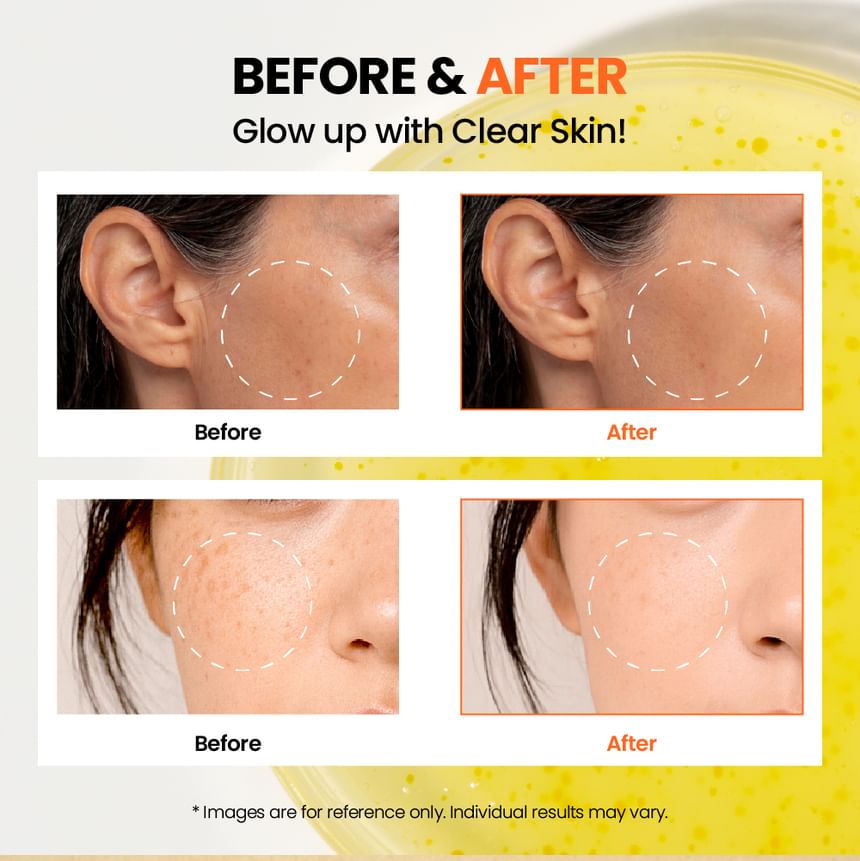 KSECRET - SEOUL 1988 Glow Serum : Niacinamide 15% + Yuja 30ml 7