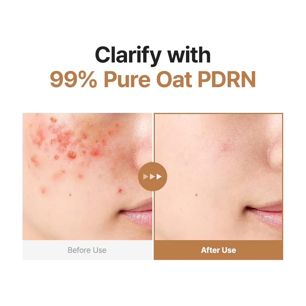 Purito SEOUL - Oat PDRN Gentle Refining Toner 200ml 3