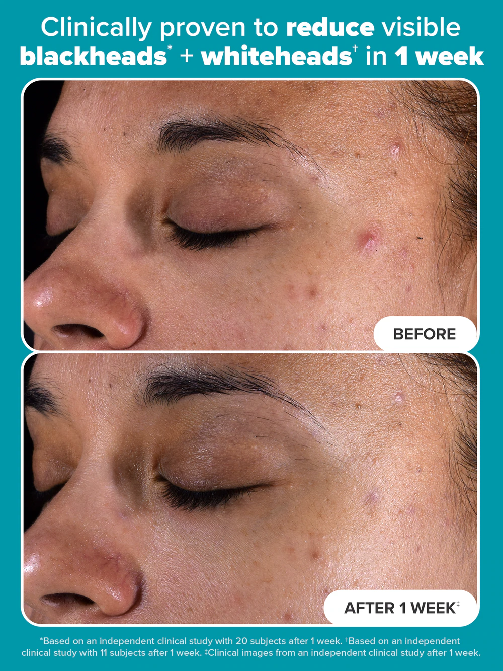 Paula’s Choice SKIN PERFECTING 2% BHA Liquid Exfoliant 30ml 2