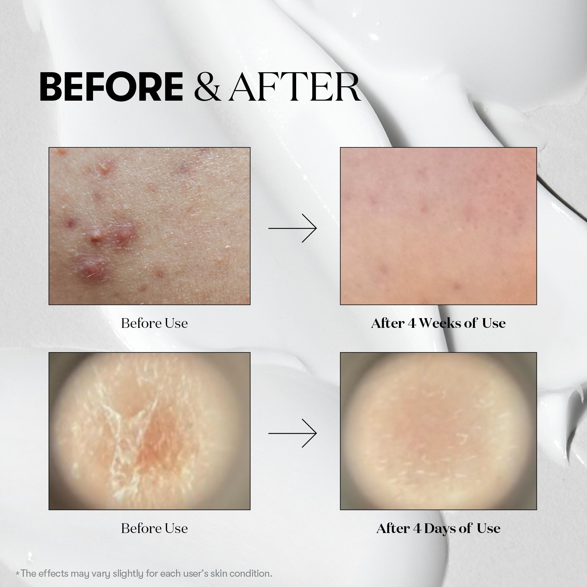 VT Cosmetics - CICA Reedle Shot 300 Essence 50ml 5