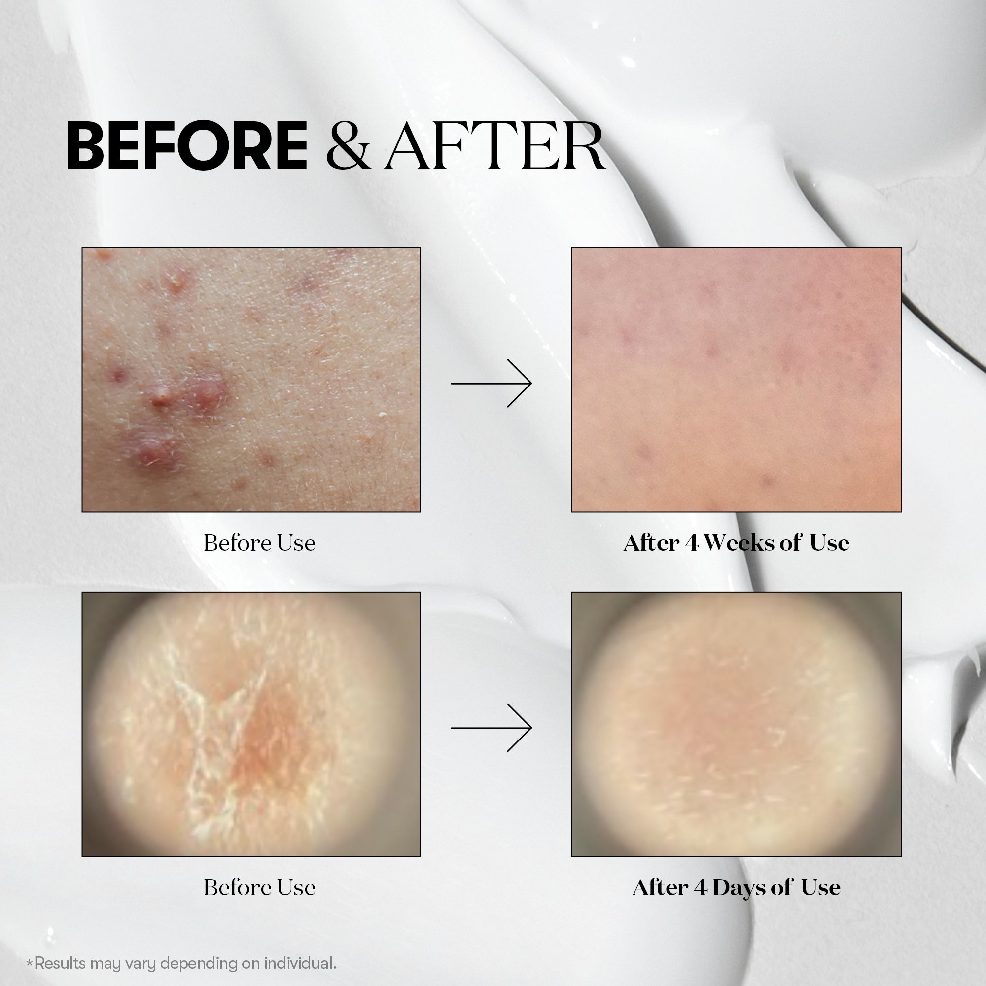 VT Cosmetics - Mild Reedle Shot 50 50ml 4