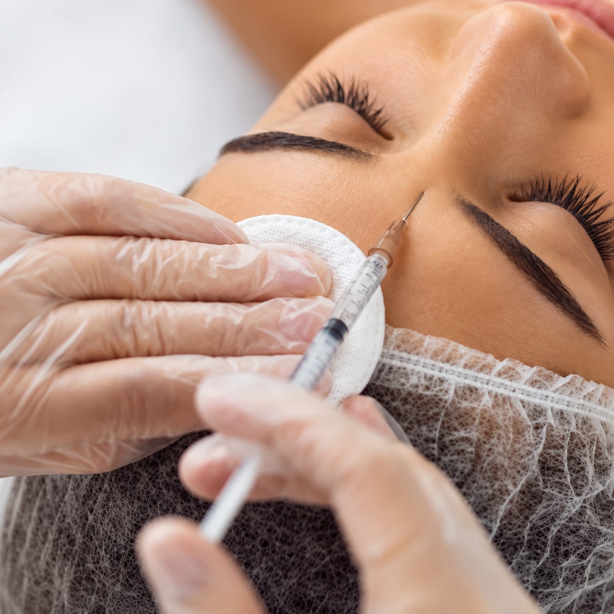 Aplica&ccedil;&atilde;o de preenchimento facial pela Dra. Daniele Murga