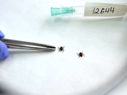 Энцефалит подтвердился у двоих абаканцев. Они не были привиты