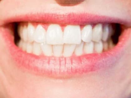 Стоматологи Хакасии рассказали, зачем и чем нужно чистить зубы