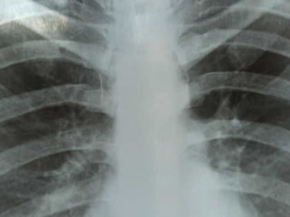 Как и где бесплатно проверить себя на онкологию?