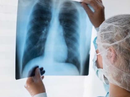 Главные симптомы рака лёгких