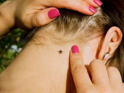 Четверо жителей Хакасии заболели клещевым тифом. Двое из них - дети