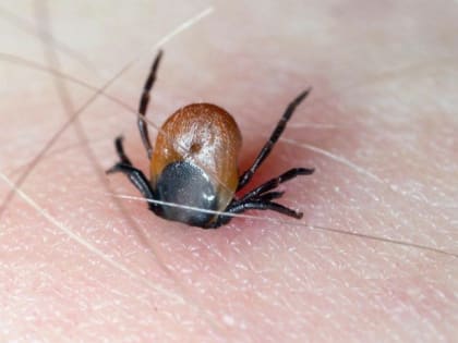 В Хакасии +2 случая энцефалита за неделю