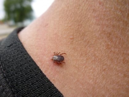 Житель Абакана заболел клещевым энцефалитом