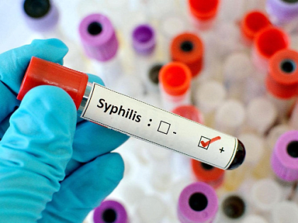 В Хакасии пошел в рост социально значимый недуг