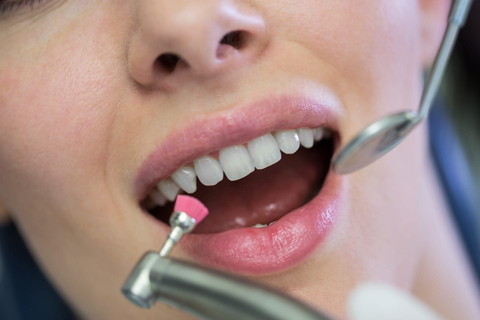 Dentist Examining Female Patient With Tools (1) - Expert Dentist in Dhaka | Smile Dental Care